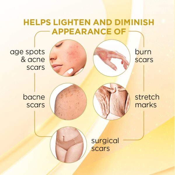 Helps Lighten And Diminish Appearance